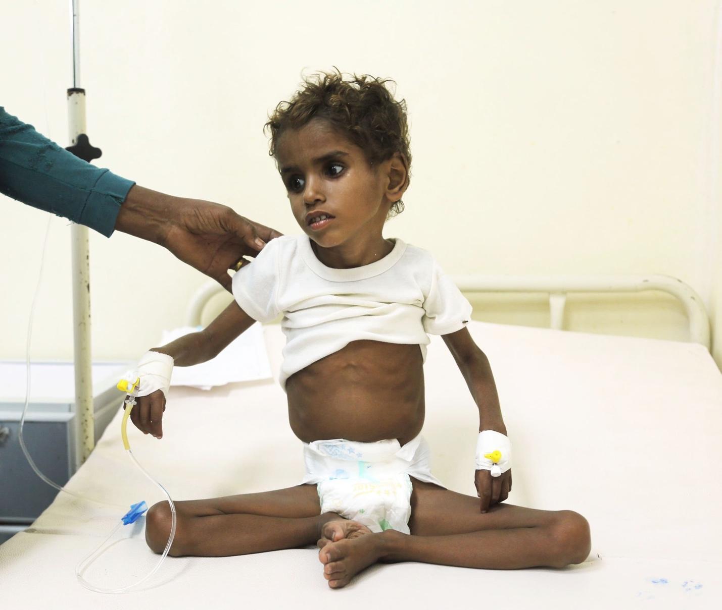 U.N., Aid Groups Warn of 'Starvation and Death' in Yemen