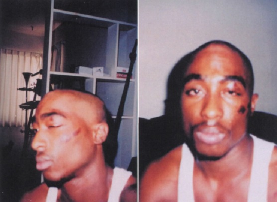 1991-10-17 / Tupac Was Brutally Assulted By a Police Officers |  2PacLegacy.net