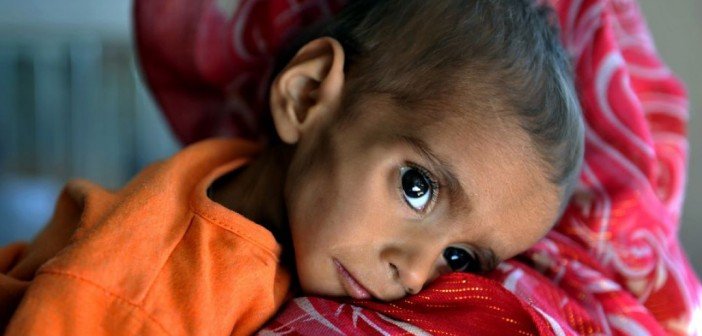 Hunger in Afghanistan