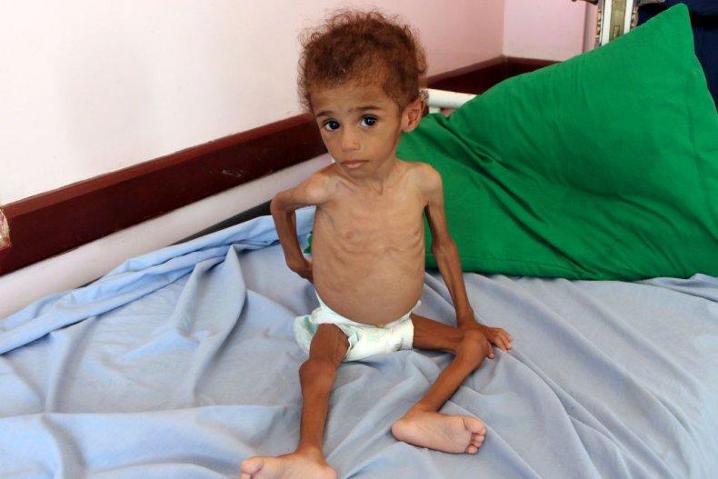 Worst Famine in 100 Years' Could See 13 Million People Starve if Saudi-Led  Coalition Keeps Bombing Yemen: U.N.
