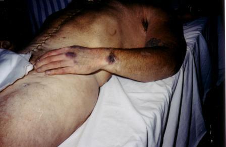 A picture containing person, person, indoor, bed

Description automatically generated