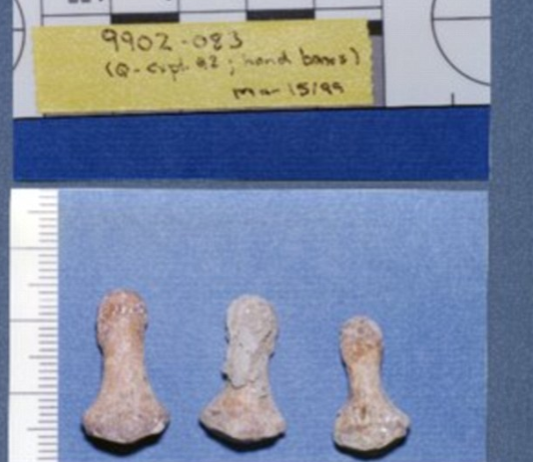 Close-up of bones

Description automatically generated