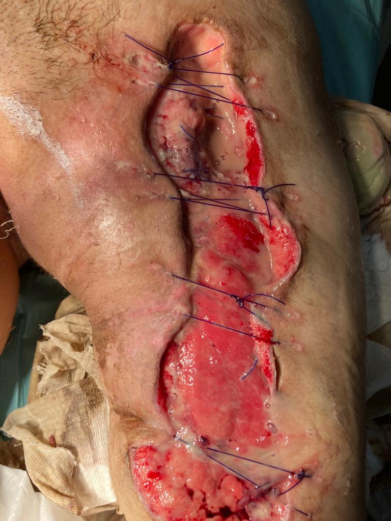C:\Users\Felix Abt\Downloads\gore\IMG-20240128-WA0016.jpg