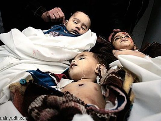 British Doctor Trying to Save Lives of Gazan Civilians Severely Injured by Israeli Bombs