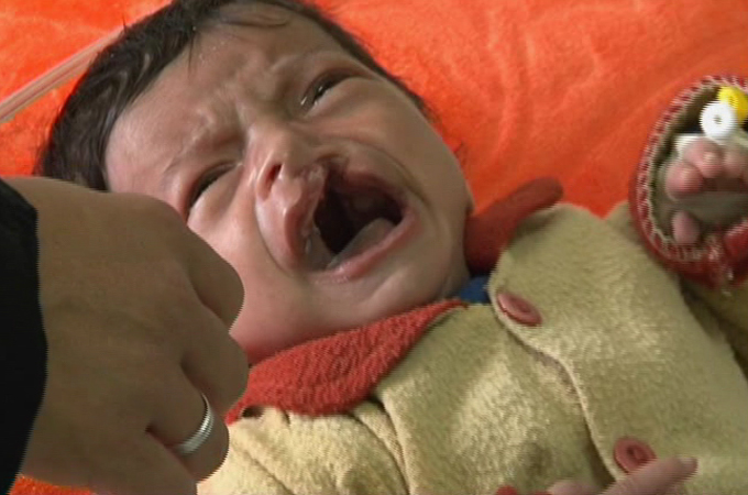 A close-up of a crying baby

Description automatically generated