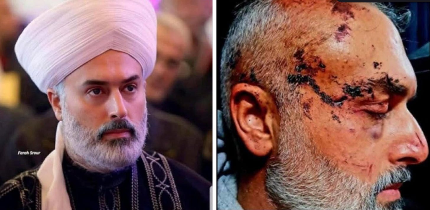 A person with a white turban and a white beard
AI-generated content may be incorrect.